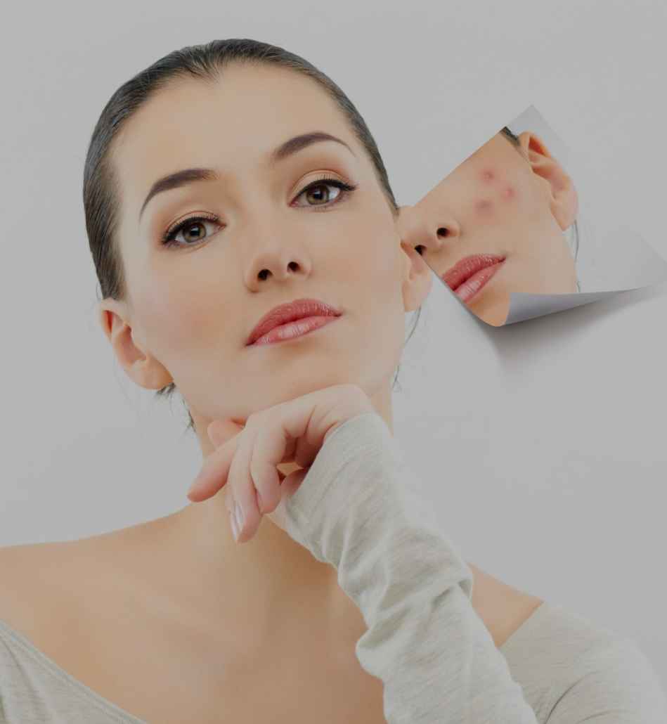 Mole Removal Treatments in Ontario, Canada by Near Me Clinics